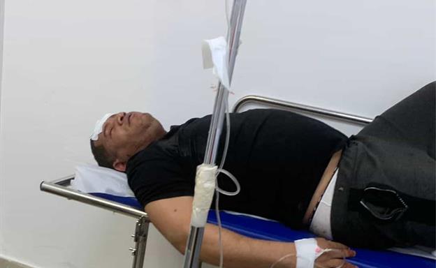 Mantequilla resulta herido en incidente que está bajo investigación de las autoridades